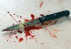 В Чуйской области жена изрезала супруга ножом