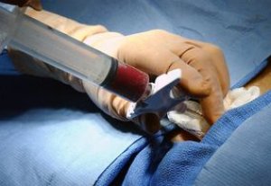Кыргызстанские ученые готовятся к третьей операции по пересадке костного мозга