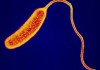 Эпидемиолог:  На каракольском пляже обнаружен непатогенный вид холеры