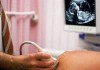 В большинстве случаев девочки-подростки не хотят официально регистрировать аборты в госмедучреждениях