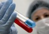 Общая площадь природных очагов чумы в Кыргызстане составляет 3 млн 200 тыс. га