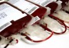 18 % сдаваемой донорами крови является бракованной