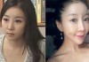 Южнокорейская телеведущая сделала себе лицо в форме сердца