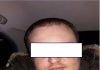Психически нездоровый любитель химии задержан по подозрению во взрыве дерева