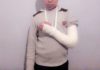 В Узбекистане учитель сломал руку пятикласснику палкой