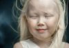 «У неё что отец русский?»: с какими проблемами сталкиваются альбиносы в Казахстане