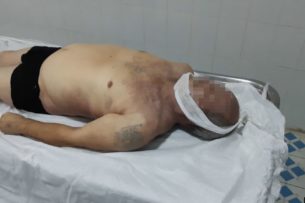 В Самарканде мужчина умер во время допроса в милиции. Родственники утверждают, что его забили до смерти
