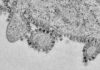 Размножение коронавируса впервые показали на фото