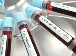 В Кыргызстане зарегистрировали 269 новых заболевших COVID-19. Умерли еще три пациента с коронавирусом
