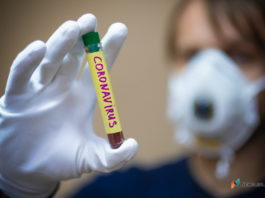 В Кыргызстане за сутки зафиксирован 371 больной коронавирусом. 4 больных скончались