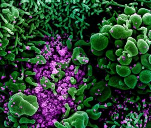 Nature: миниатюрные органы показывают, как коронавирус поражает организм