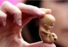 Ученые вырастили модель эмбриона человека из клеток кожи