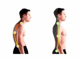 Вредно ли сутулиться?