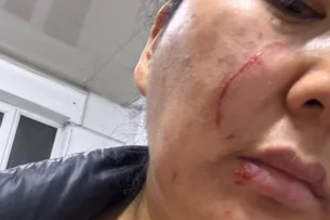 Конфликт в Кара-Жыгаче: Женщина из видео рассказала свою версию, показала ушибы и раны