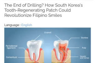 Пластырь для регенерации зубов изобрели в Корее