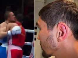 «Это не собачьи бои». Тренер Узбекистана — о том, как российский боксёр укусил узбекистанца в финале ЧМ