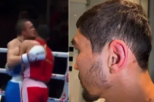 «Это не собачьи бои». Тренер Узбекистана — о том, как российский боксёр укусил узбекистанца в финале ЧМ «Это не собачьи бои». Тренер Узбекистана — о том, как российский боксёр укусил узбекистанца в финале ЧМ