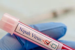 Минздрав Кыргызстана: На территории страны случаи заболевания вирусом Нипах не зарегистрированы