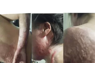 Муж облил жену бензином и поджег ее: Институт Омбудсмена рассказал подробности трагедии