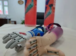 Минтруда КР: более 11,5 тысячи человек получили протезно-ортопедические услуги в 2025 году