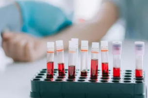 Кыргызстанцам советуют бесплатно проверить уровень гемоглобина. Если откажут в бесплатном анализе обратиться в ФОМС