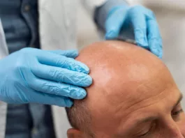 Учёные приблизились к выращиванию волос для лечения облысения