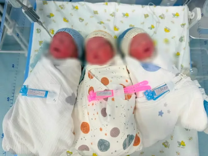 Three babies are born safely in Bishkek after a high-risk quadruplet pregnancy